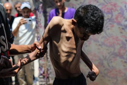 Gazze'de "Salgın hastalık" uyarısı